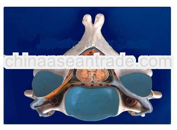 Anatomical Model-Fifth Cervical Vertebrae with spinal cord